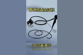 胃镜检查过程#无痛胃肠镜