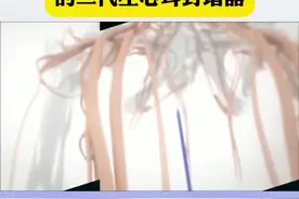 封闭心耳，预防血栓 来看看预防房颤血栓的第二代左心耳封堵器#医学科普 #房颤与中风 #房颤 #左心耳封堵术视频封面