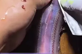 这个鳝鱼里面好多寄生虫哟，吓死人了！