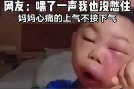 宝宝被蜜蜂蛰，妈妈一边偷笑！ 网友辣评：心痛的上气不接下气。 #看一遍笑一遍 #被蜜蜂蛰了 #萌娃 #宝宝心里苦宝宝不说视频封面