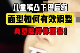 儿童腺样体面容早期矫正 #牙齿矫正 #腺样体面容 #下巴后缩 #正畸 #儿童正畸