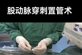 股动脉穿刺置管，血管内介入治疗第一步