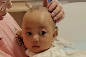 宝宝确诊胆道闭锁、肝硬化失代偿、顽固性胆管炎，妈妈决定捐肝不远千里求医上海#胆道闭锁 #胆汁淤积 #肝硬化 #肝移植 #葛西手术 @热门 @抖音短视频视频封面