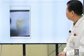 早起咳嗽痰液出现血丝这到底是怎么回事？ #咳痰 #中医 #健康科普