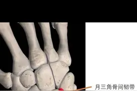 拳击运动员在训练中经常会腕痛，大部分都是TFCC损伤损伤，让康复师来教你如何康复#按摩放松 #拳击 #格斗 #运动损伤 #tfcc视频封面