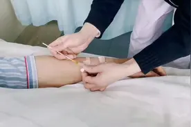 留置针冲封管方法