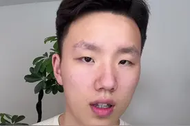 X型腿，膝盖内侧鼓包，假胯髋的姐妹儿，这2个纠正动作一定要练 #x型腿 #膝盖内侧凸起 #减脂 #塑形 #健身