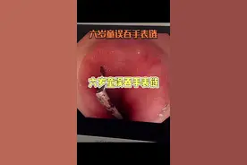 #硬核健康科普行动 #2024都有好好爱自己#儿童吞异物 #小孩误吞异物怎么办 #儿童安全视频封面