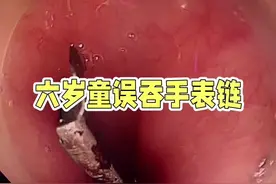 #硬核健康科普行动 #2024都有好好爱自己#儿童吞异物 #小孩误吞异物怎么办 #儿童安全视频封面