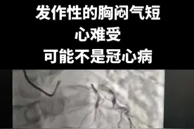 发作性的胸闷气短，心难受，可能不是冠心病@心脏科医生张晶 脱口秀 #硬核健康科普行动 #胸闷气短 #冠心病 #心肌桥