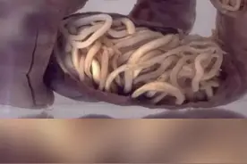 孩子光吃不长肉？很可能是有蛲虫!#蛲虫 #发育 #健康 #医疗健康创作训练营 ，#抖出健康知识宝藏