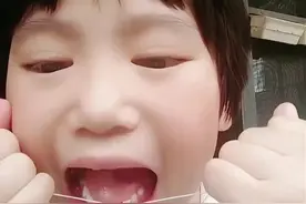 #小孩拔牙齿正确方法 #是时候展现真正的技术了 #涨粉1000万