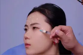 一支肉毒素搞定全脸除皱提升 #肉毒素 #除皱针 #面部提升 #变美视频封面