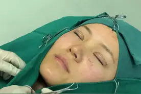 做双眼皮要把脸包起来你知道为什么吗？#手术室你不知道的事 #手术室日常 #双眼皮 #双眼皮手术
