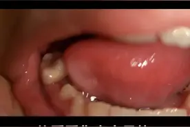 小乳牙自己松动脱落才是恒牙生长发育正常的现象哦。 #口腔科普 #爱牙护牙