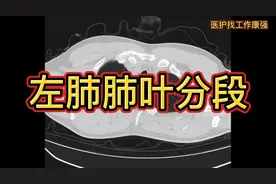 #小鹅通微店 CT影像基础：左肺肺叶分段识别，收藏学习！