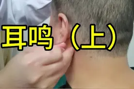 耳鸣，耳闷胀堵塞感。#耳鸣 #扎针 #门诊日常 3视频封面