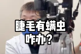 眼睛里有虫子？ 睫毛上检查出螨虫是什么回 事？该怎么处理？ #干眼症 #睑板腺功能障碍 #蠕形螨睑缘炎 #螨虫 #除螨视频封面