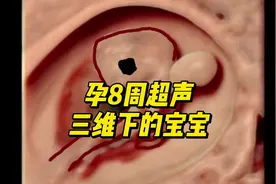 孕8周超声检查 来看看三维下的宝宝！#孕期知识 #孕期b超视频封面