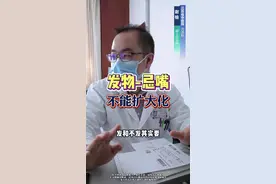 发物忌嘴不能扩大化 #饮食 #发物 视频封面