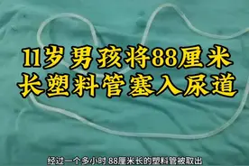 11岁男孩将88厘米长塑料管塞入尿道视频封面