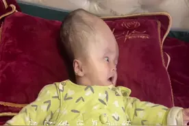 平凡的记录脑积水宝宝康复训练的过程，经过不断的康复训练，宝贝终于可以自己活动自己的大脑袋，感谢支持和鼓励关心我们的娘家人我们定不会辜负您对我们的期望，我们会用时间来证明一切，我们定能向大家期望的样子不断的提升进步走向健康，世间有爱眼里，有光希望世界上所有的孩子都能健康快乐平安的成长#我不完美但我真实 #康复路上很艰苦 #脑积水新宝 #生活百味 #宝宝快点好起来 @抖音短视频视频封面