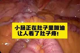 小肠正在蠕动，跟你想象的一样吗？肚子有没有隐隐作痛