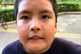 #超雄综合征面部特征