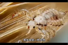 人体十大寄生虫#疾病预防 #知识科普 #视频封面