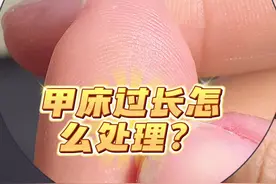 甲床过长怎么办 碰东西疼#美甲 #美甲vlog #贴甲片教程 #指甲修复的方法 #短指甲也可以这么美视频封面
