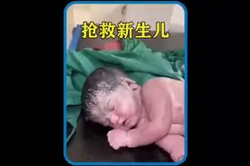 新生儿被羊水呛得无法呼吸，刚出生下两分钟就面色发白视频封面