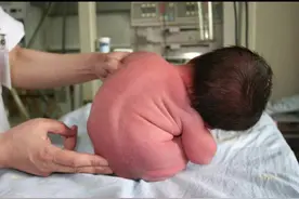 #胎儿发育#胎儿大畸形筛查#胎儿畸形 #四维彩超 #超声学习 #安慕希爱冒险春日计划