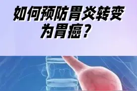 谨防胃炎变胃癌！#胃炎 #胃癌 #黑便 #腹痛 #董剑宏胃癌工作室