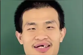 韦东奕的牙“去哪了”？#韦东奕视频封面