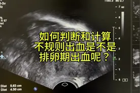 如何判断和计算不规则出血是不是排卵期出血呢？#超声学习 #b超视频封面