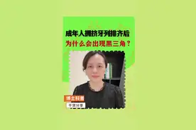 正畸后黑三角 #硬核健康科普行动 #健康生活重养自己一遍  #正畸 #牙齿矫正  #广州牙医