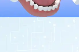 你知道牙齿矫正中，矫正用的托槽是如何粘接的吗? #口腔科普 #牙齿🦷 #一口好牙 #牙齿矫正