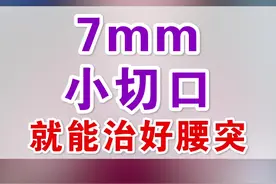 #腰椎间盘突出 #医学科普 #我的门诊故事 视频封面