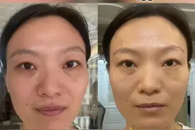 太阳穴凹陷影响面部轮廓不好看？跟练这四个动作，一星期就会有明显改善#面部瑜伽 #大小脸 #面部提升 #面部不对称 #体态纠正视频封面