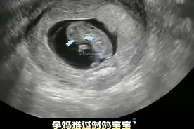 孕妇别哭保持好心情 #孕妇哭了对胎儿的影响 #怀孕哭对胎儿有影响吗 #怀孕难过哭会影响宝宝吗 #胎宝宝在肚子里的状态 #孕妇心情好对胎儿的好处