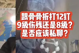 脚跟骨骨折，打了12个钉，是9级伤残还是8级？可以私了赔偿吗？视频封面
