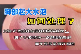 脚丫子起大水泡如何处理，分享给大家！#脚起泡#没法过520视频封面