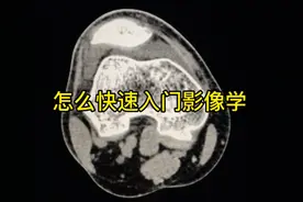 如何快速入门医学影像学，听听宋医生怎么说#医学影像视频封面