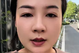 同款痣你要去吗？#祛痣 #痣的魅力发散时间 #法令纹上的痣要不要消除
