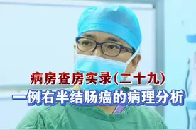 一例右半结肠癌的术后病理分析！ #抖出健康知识宝藏 #一种看似偷懒其实健康的行为 #抖音热点 #科普一下 #癌症 @抖音健康 @抖音热点 @抖音短视频视频封面