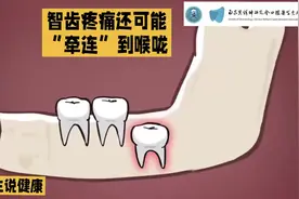 智齿疼痛还会连累喉咙吗？#智齿疼 #口腔科普视频封面