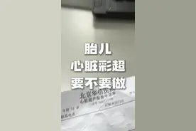 这个你们有打算做的吗姐妹们 #孕妈 #顺产 #孕晚期 #产检视频封面
