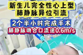 新生儿完全性心上型肺静脉异位引流 2个半小时完成手术 肺静脉吻合口流速0.6m/s#先天性心脏病#完全性肺静脉异位引流 #肺动脉高压#阜外张岩伟视频封面