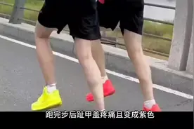 经常跑完长距离脚指甲发紫，看看你是那种情况造成的？ #跑步