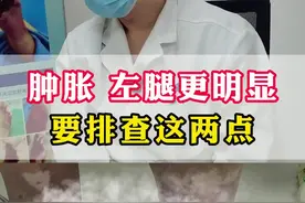 淋巴水肿左腿更明显，要排查这两点 #淋巴水肿 #肿胀 #硬核健康科普行动 #门诊日常视频封面